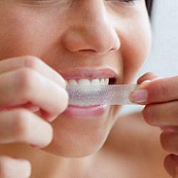 Sbiancamento dentale  - Trattamenti fai da te