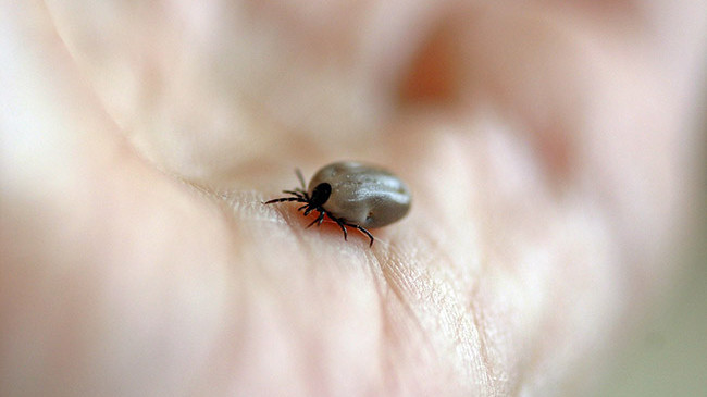 Puntura di zecca che provoca la Malattia di Lyme