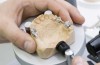 Con l'implantologia dentale la masticazione diventa efficace
