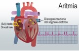 Anomalia del cuore