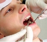 Il dente del giudizio spesso causa di dolorose patologie